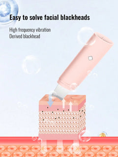 Ultrasonic Skin Scrubber Facial Cleaner Ion Acne Blackhead Remover